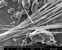 Anfibolasbestos, tremolite in gesso - risoluzione standard: 654 x 522 px/dimensione file ca. 0,35 MB | © CRB Analysis Service GmbH