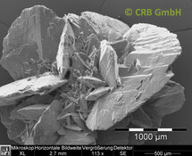 Calculs rénaux en oxalate de calcium | © CRB Analyse Service GmbH