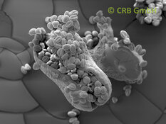 Capsula di semi rotta di euforbia leuconeura | © CRB Analysis Service GmbH