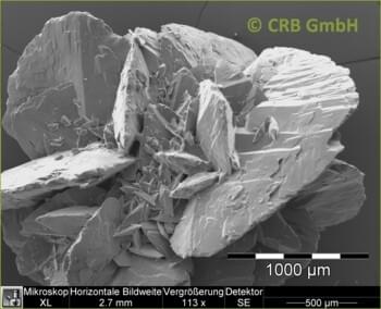 Calculs rénaux en oxalate de calcium
