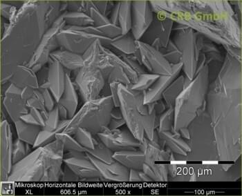 Calculs rénaux en oxalate de calcium
